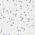 MYEF2 Antibody in Immunohistochemistry (Paraffin) (IHC (P))