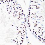 MYEF2 Antibody in Immunohistochemistry (Paraffin) (IHC (P))