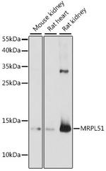 MRPL51 Polyclonal Antibody
