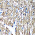 C3orf1 Antibody in Immunohistochemistry (Paraffin) (IHC (P))