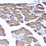 C3orf1 Antibody in Immunohistochemistry (Paraffin) (IHC (P))