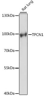 TPCN1 Polyclonal Antibody