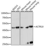 ACTR10 Polyclonal Antibody