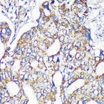 MRPS35 Antibody in Immunohistochemistry (Paraffin) (IHC (P))