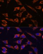 MMP25 Polyclonal Antibody