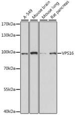 VPS16 Polyclonal Antibody
