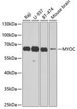 MYOC Polyclonal Antibody