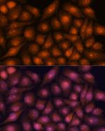 DDX31 Antibody in Immunocytochemistry (ICC/IF)