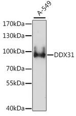 DDX31 Antibody in Western Blot (WB)