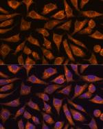 B3GNT4 Polyclonal Antibody