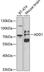 alpha Adducin Polyclonal Antibody