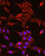 TRIM4 Polyclonal Antibody