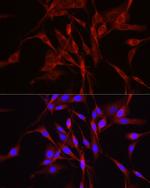 TRIM4 Antibody in Immunocytochemistry (ICC/IF)