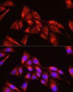 TRIM4 Antibody in Immunocytochemistry (ICC/IF)