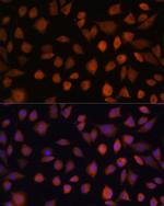 ARMC6 Polyclonal Antibody