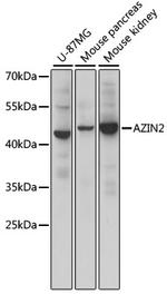 ADC Polyclonal Antibody
