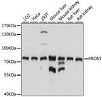 PROTEIN S Polyclonal Antibody