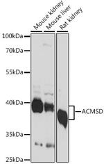 ACMSD Polyclonal Antibody