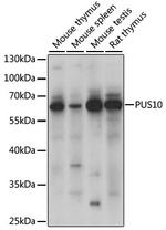 PUS10 Polyclonal Antibody