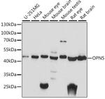 Opsin 5 Polyclonal Antibody