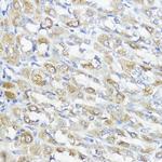 GPX2 Antibody in Immunohistochemistry (Paraffin) (IHC (P))