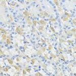 GPX2 Antibody in Immunohistochemistry (Paraffin) (IHC (P))