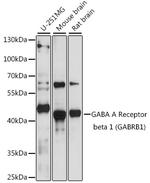 GABRB1 Polyclonal Antibody