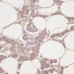 Laminin gamma-1 Polyclonal Antibody