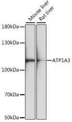 ATP1A3 Polyclonal Antibody