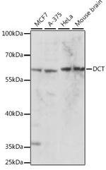 DCT Polyclonal Antibody
