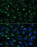 ETFB Polyclonal Antibody