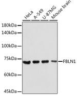 Fibulin 1 Polyclonal Antibody