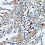 MEKK3 Antibody in Immunohistochemistry (Paraffin) (IHC (P))