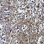 MEKK3 Antibody in Immunohistochemistry (Paraffin) (IHC (P))