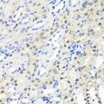 TRIM27 Polyclonal Antibody