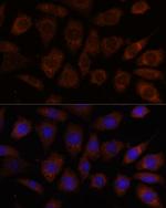SEC24D Polyclonal Antibody