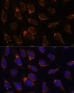 TSFM Polyclonal Antibody