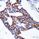 Epsin 2 Polyclonal Antibody