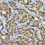 Cdc2L6 Polyclonal Antibody