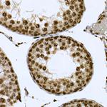 Cdc2L6 Antibody in Immunohistochemistry (Paraffin) (IHC (P))