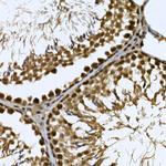 Cdc2L6 Antibody in Immunohistochemistry (Paraffin) (IHC (P))