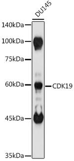 Cdc2L6 Antibody in Western Blot (WB)