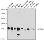CK2 beta Antibody in Western Blot (WB)