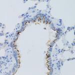 PTGER2 Antibody in Immunohistochemistry (Paraffin) (IHC (P))