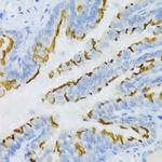 PTGER2 Antibody in Immunohistochemistry (Paraffin) (IHC (P))