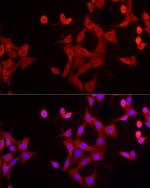 EpoR Antibody in Immunocytochemistry (ICC/IF)