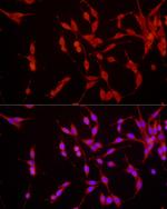 EpoR Antibody in Immunocytochemistry (ICC/IF)