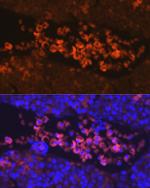 EpoR Antibody in Immunohistochemistry (Paraffin) (IHC (P))