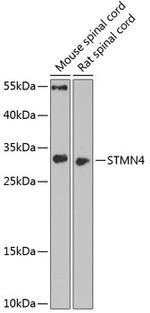 STMN4 Polyclonal Antibody