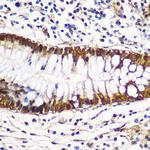 14-3-3 gamma Polyclonal Antibody